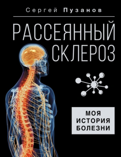 Рассеянный склероз. Моя история болезни - Сергей Пузанов
